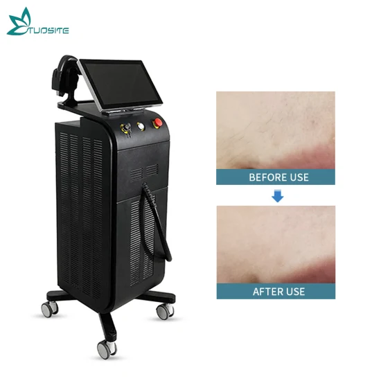 Best Price 755/808/1064 Diode Laser Hair Removal Device